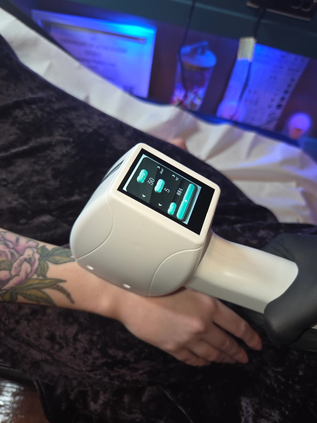 photo of diode laser hair removal treatment on an arm